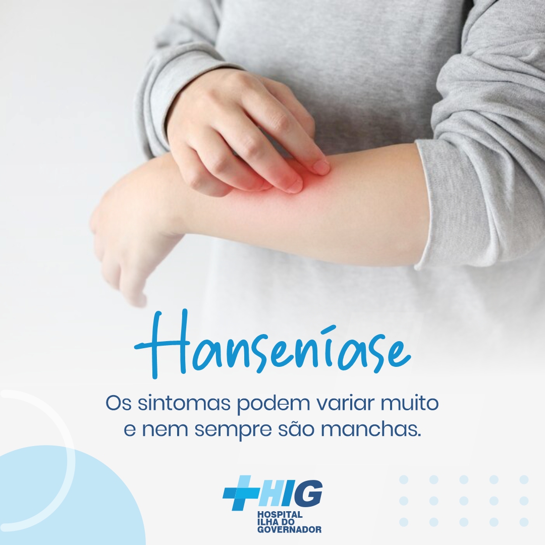 Hanseníase, o que é? - Hospital Ilha do Governador