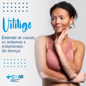 Vitiligo: entenda as causas, os sintomas e tratamentos da doença